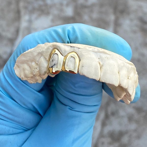 Real 14K Gold Double Side Canine Open Face Caps Custom Grillz Online Sale - Image 5
