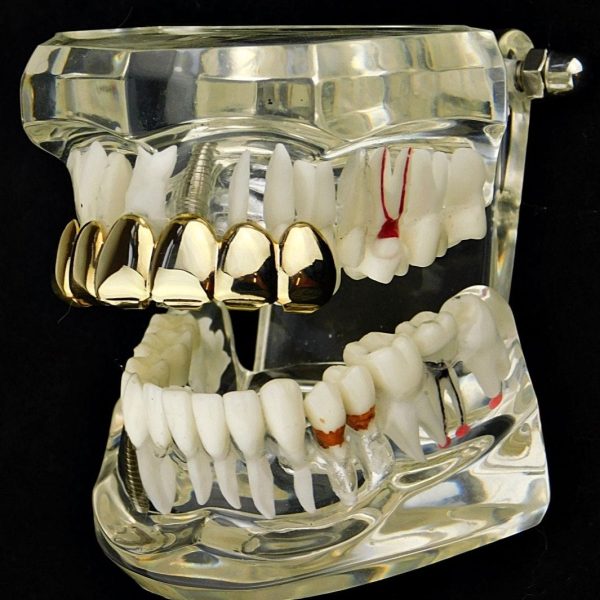 14K Gold Plated Deeper-Cut Top Teeth Plain Grillz Supply - Image 4