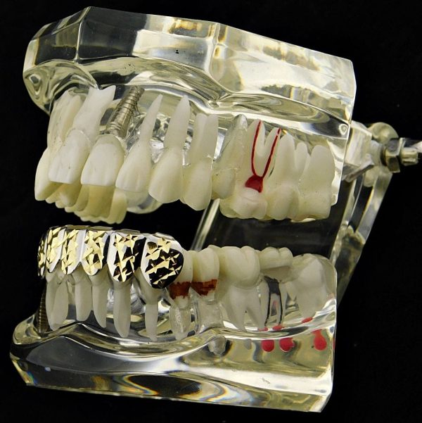 Silver Tone with w 14K Gold Plated Diamond-Cuts Bottom Teeth Grillz Online now - Image 4