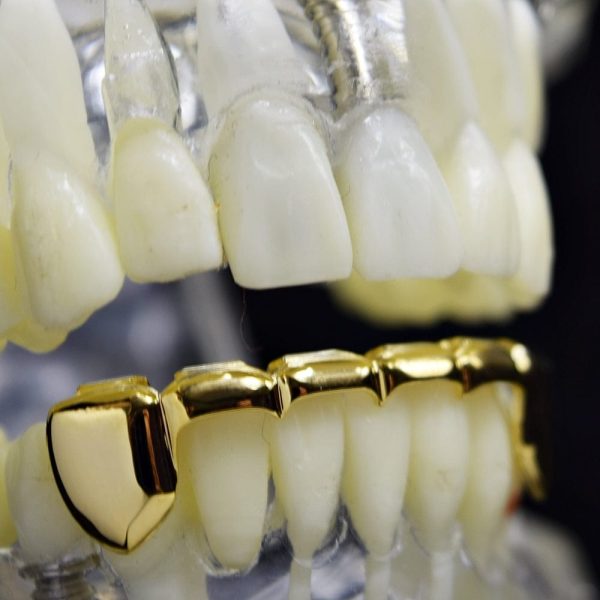 14K Gold Plated Slim Bar Bottom Teeth Grillz Supply - Image 5