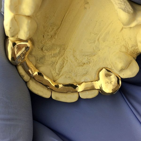 Real 14K Gold 2-Tone Diamond Dust Custom Caps Grillz w Back Bar Online - Image 5