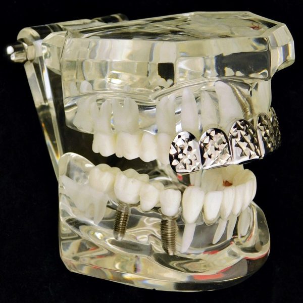 Silver Tone Diamond-Cut Top Teeth Grillz on Sale - Image 3