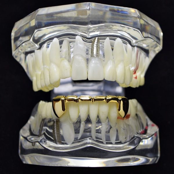 14K Gold Plated Slim Bar Bottom Teeth Grillz Supply - Image 2