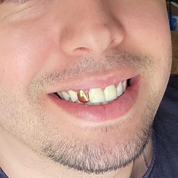 Real 14K Solid Gold Single Cap Custom Grillz (Choose Tooth) Sale - Image 4