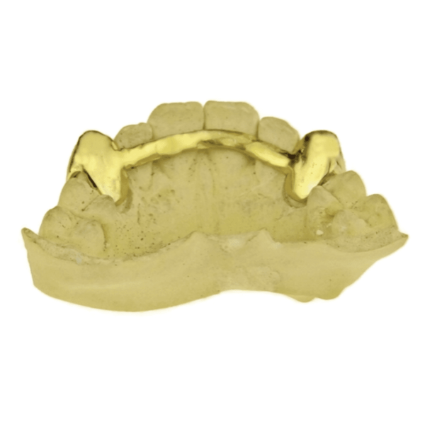 Gold Plated over 925 Silver Open Face Canine Custom Caps Online now - Image 5