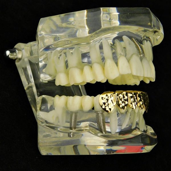 14K Gold Plated Diamond-Cut Bottom Teeth Grillz Online Sale - Image 3