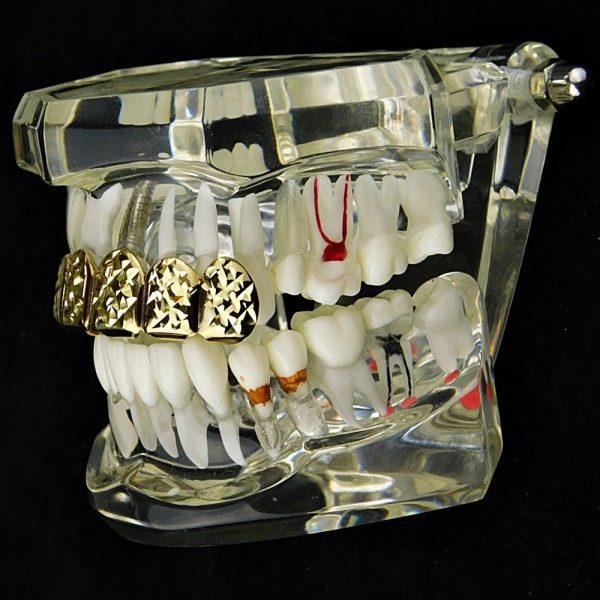 14K Gold Plated Diamond-Cut Top Teeth Grillz Cheap - Image 5