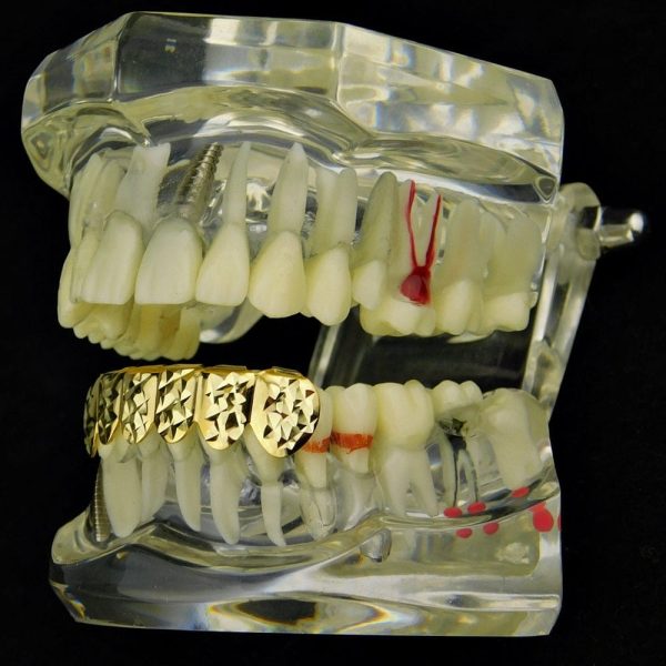 14K Gold Plated Diamond-Cut Bottom Teeth Grillz Online Sale - Image 4