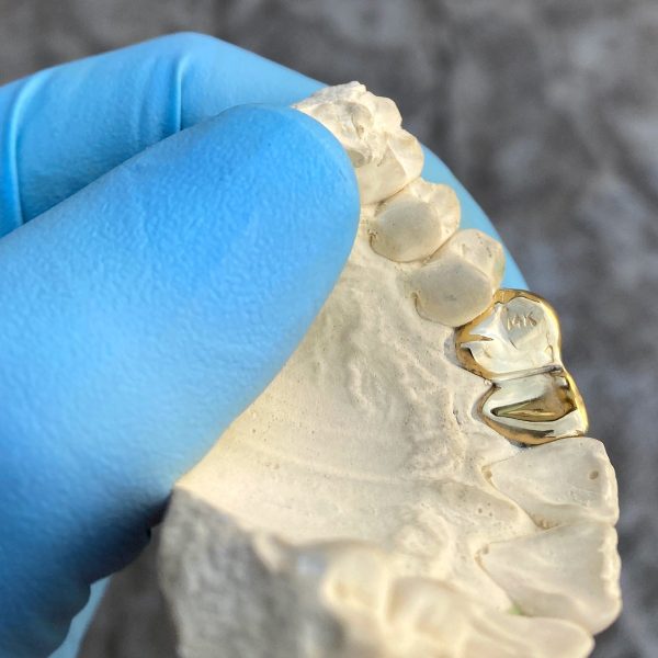 Real 14K Gold Double Side Canine Open Face Caps Custom Grillz Online Sale - Image 3