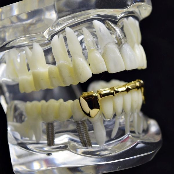 14K Gold Plated Slim Bar Bottom Teeth Grillz Supply - Image 3