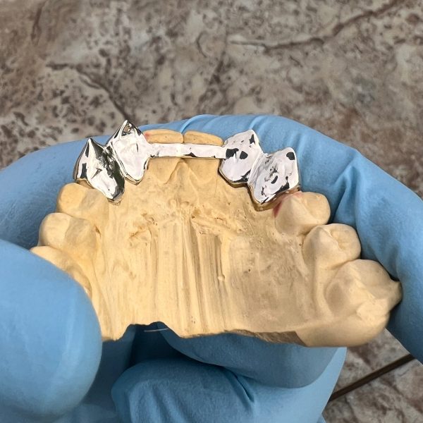 925 Sterling Silver Double Vampire Fangs Open Face Custom Grillz For Sale - Image 3