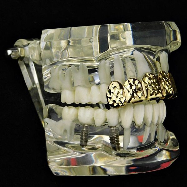 14K Gold Plated Diamond-Cut Top Teeth Grillz Cheap - Image 3