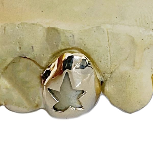 10K Gold Custom Cap Grillz Single Star Cutout Open Face One Tooth on Sale