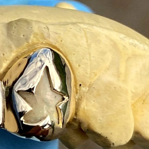 10K Gold Custom Cap Grillz Single Star Cutout Open Face One Tooth on Sale - Image 5