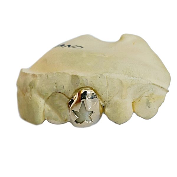 10K Gold Custom Cap Grillz Single Star Cutout Open Face One Tooth on Sale - Image 3